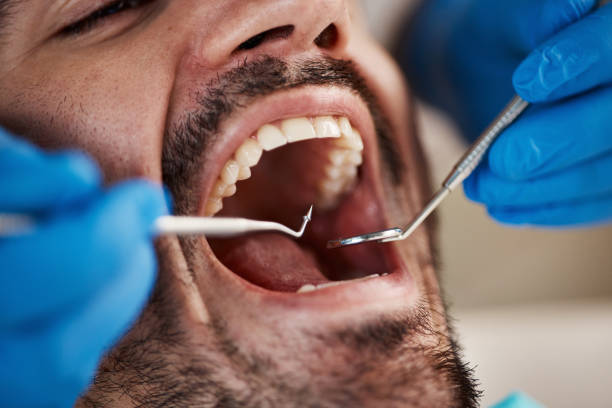 Best Broken or Chipped Tooth Repair in Woodland Hills, UT