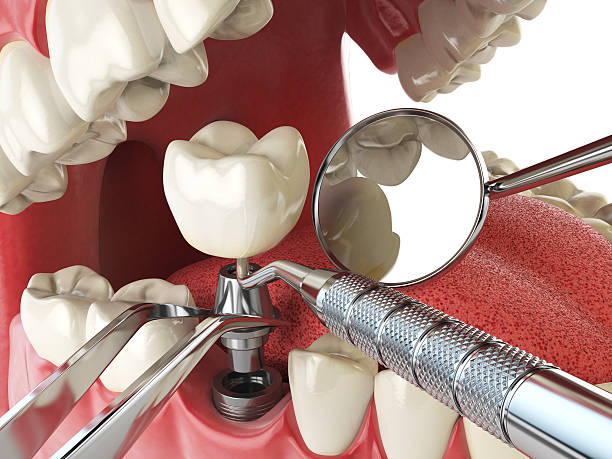 Best Emergency Treatment for Jaw Pain or Injury in Woodland Hills, UT
